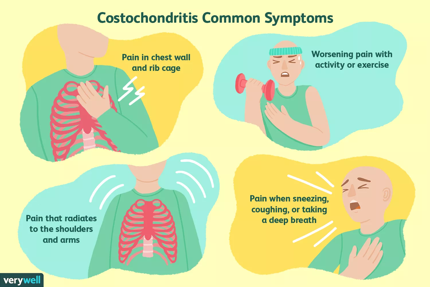 Costochondritis and Fibromyalgia: The Connection