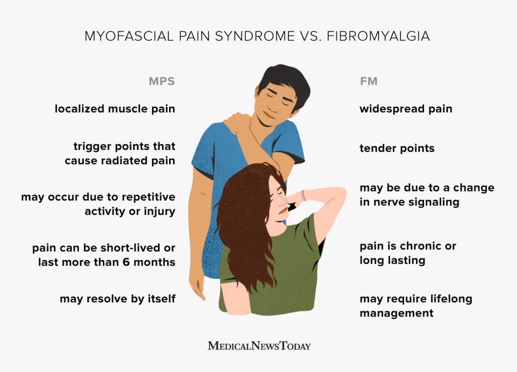 Myofascial pain syndrome and fibromyalgia