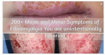 200 Major and Minor Symptoms of Fibromyalgia You are unintentionally Ignoring