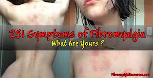 251 Symptoms of fibromyalgia (hard to believe). What are yours?